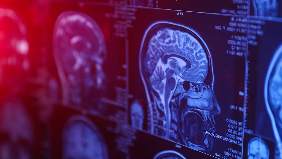 איך אמבטיית קרח מגבירה את רמות הדופמין?